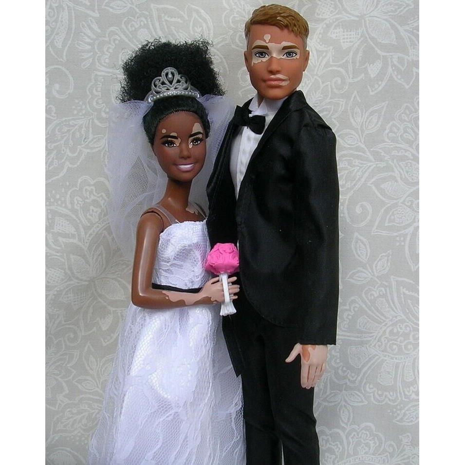 Barbie Ken Vitiligo Fashionistas Interracial Bride Groom Dolls