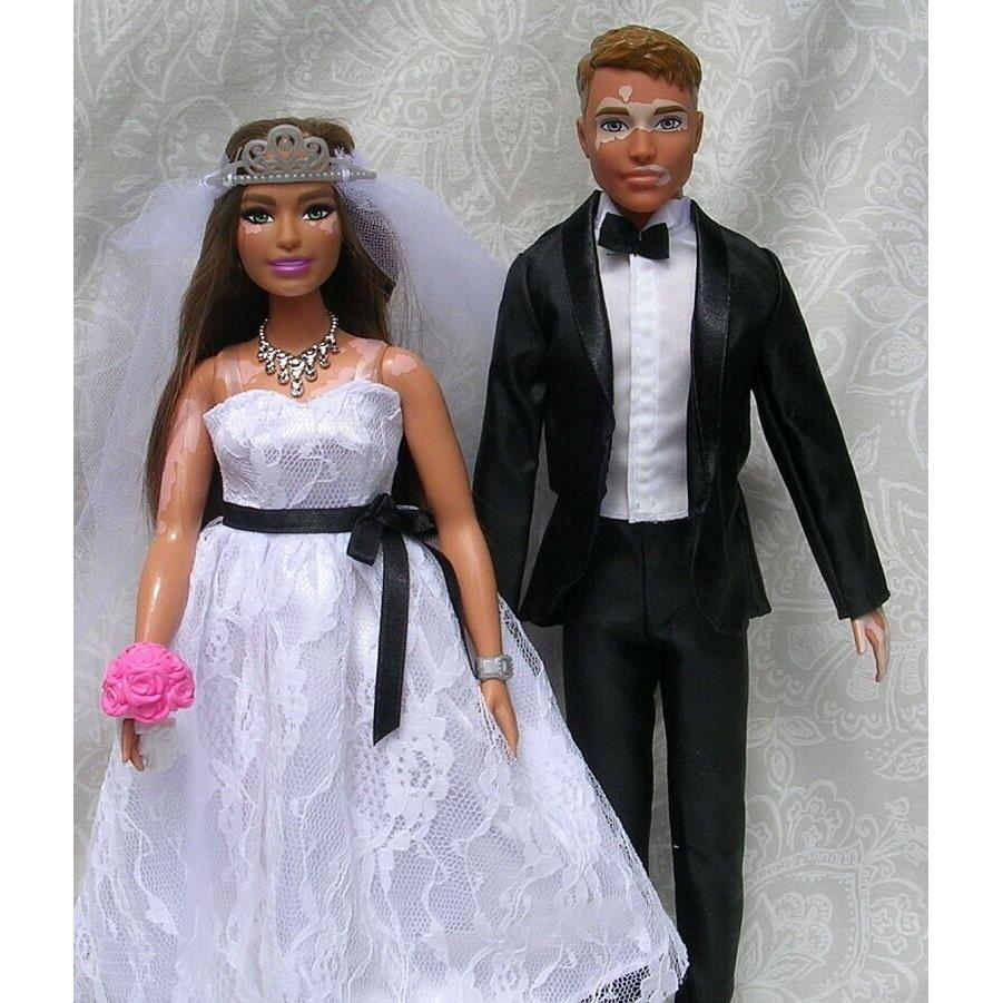 Barbie Ken Vitiligo Fashionistas Interracial Curvy Bride a Groom Doll